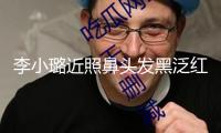 李小璐近照鼻頭發(fā)黑泛紅，43歲了還在尋求少女感，完全變成幼態(tài)臉